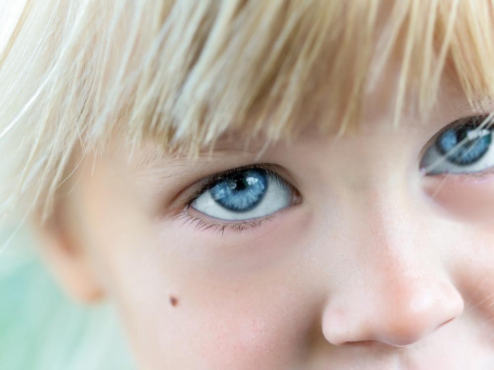 Udsnit af ca. 3 årigt barns ansigt, barnet har blå øjne og ser bekymret ud.